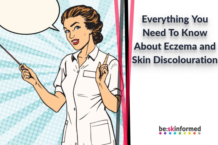 Everything You Need To Know About Eczema and Skin Discolouration
