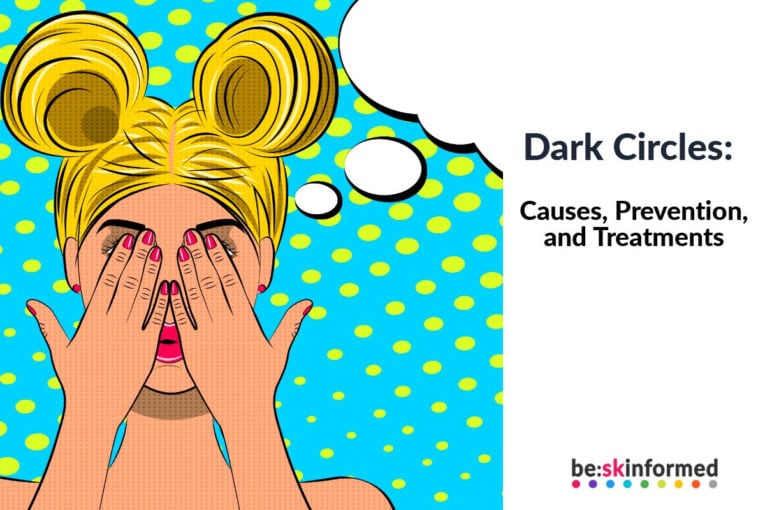 Dark Circles: Causes, Prevention, and Treatments